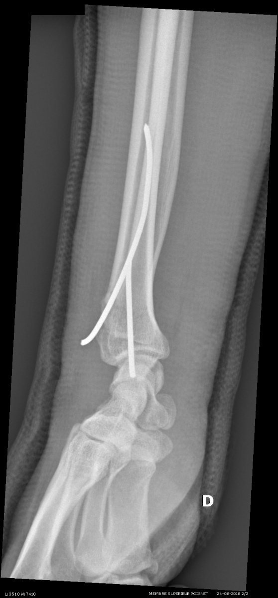 0_1540191165956_image1 (2).jpg